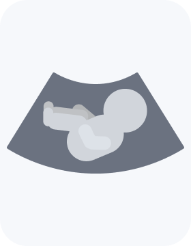 پیش بینی جنسیت جنین