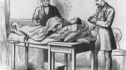 تاریخچه سزارین