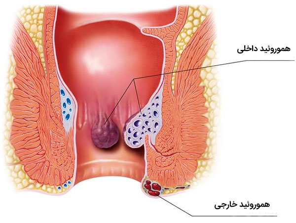 سکس مقعدی - سکس از پشت