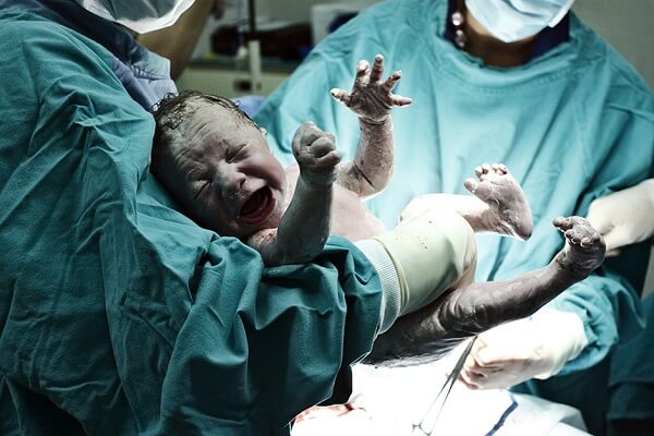 نوزاد تازه متولد شده