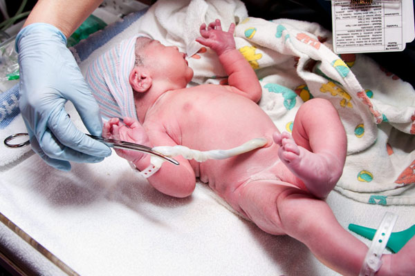 تست آپگار - تعیین نمره آپگار نوزاد