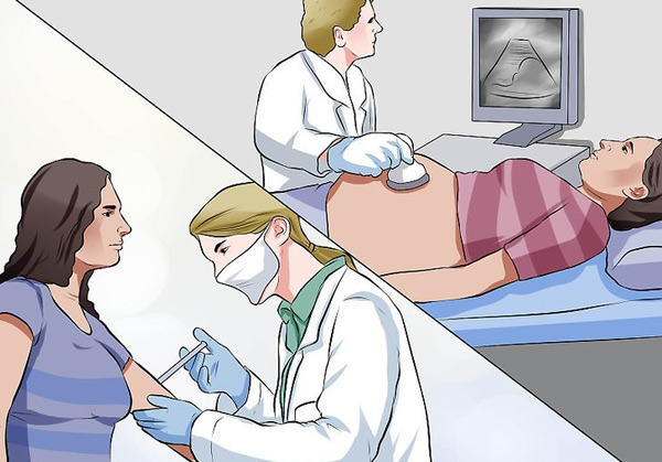 مسمومیت بارداری - علائم مسمومیت بارداری